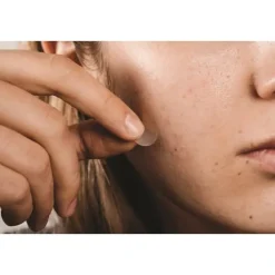 AhavaLes Pépites Beauté                Patchs Stop Boutons