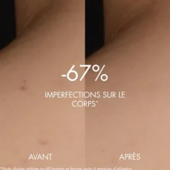 BiothermBiocorps Sérum Anti-Imperfections