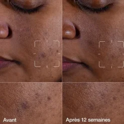 CLINIQUEEven Better Clinical™                Sérum Illuminateur Anti-taches