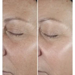 CLINIQUESmart Clinical Repair                Sérum Correcteur Anti-Rides