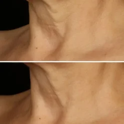 CLINIQUESmart Clinical Repair™                 Crème Liftante Visage + Cou