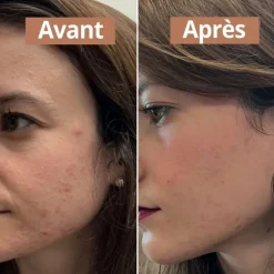 Comme AvantSérum Anti-Imperfections                Soin Visage