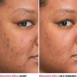 It CosmeticsBye Bye Dark Spots                Sérum Anti-taches à la Niacinamide