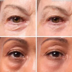 It CosmeticsBye Bye Under Eye Bags                Traitement pour les poches