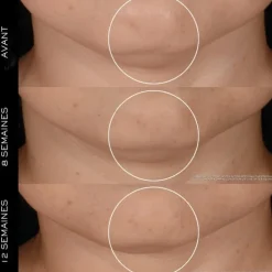 LANCÔMERénergie H.P.N. 300-Peptide                Crème Anti-Âge Haute-Performance